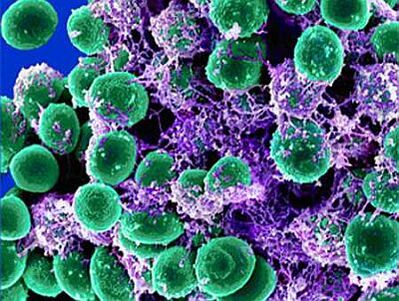 Agents pathogènes urogénitaux de la prostatite