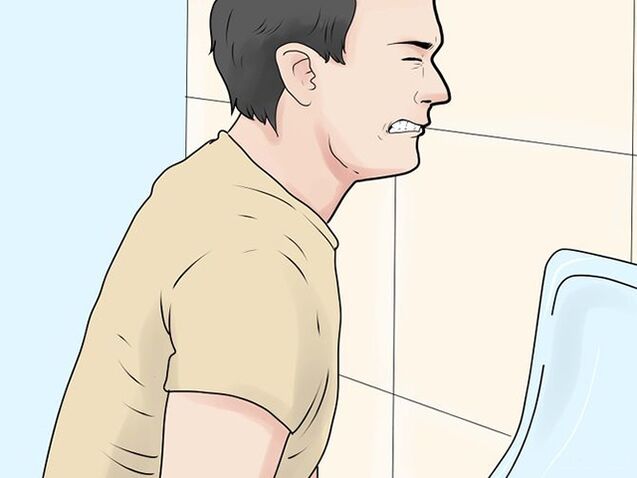 Miction douloureuse due à une prostatite
